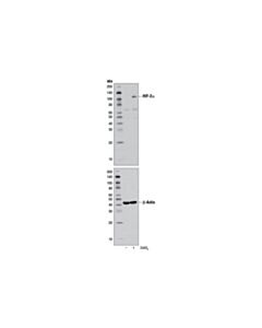 Cell Signaling HIF-2alpha (D9E3) Rabbit mAb 20 uL