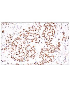 Cell Signaling Cpsf4 (E2l2z) Rabbit mAb