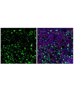 Cell Signaling Ki-67 (D3B5) Mouse Chimeric mAb