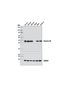 Cell Signaling Annexin A2 (D11G2) Rabbit mAb (BSA and Azide Free) 100 ug