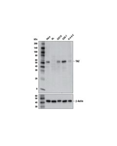 Cell Signaling Taz (E5p2n) Mouse mAb