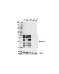 Cell Signaling Galectin-9 (D9r4a) Xp ® Rabbit mAb (BSA And Azide Free)