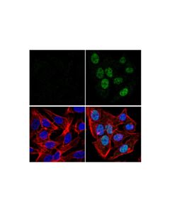 Cell Signaling Hif-2alpha (E8e5z) Rabbit mAb