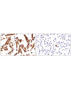 Cell Signaling Glut1 (Ihc404) Mouse mAb