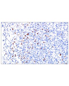 Cell Signaling NCR1/NKp46 (F8M2L) Rabbit mAb (IHC Formulated)