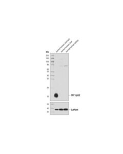 Cell Signaling Tff1/Ps2 (D2y1j) Rabbit mAb (BSA And Azide Free)