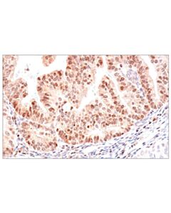 Cell Signaling ADAR1 p150 Isoform (E6U1U) Rabbit mAb