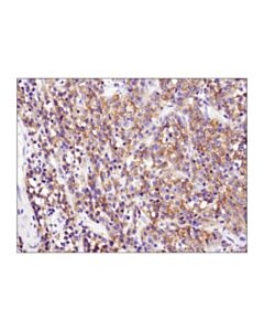 Cell Signaling CXCR5 (D6L3C) Rabbit mAb 20 uL