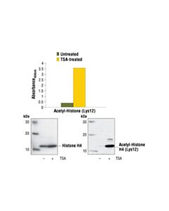 Cell Signaling Pathscan Acetyl-Histone H4 (Lys12) Sandwich ELISA Kit