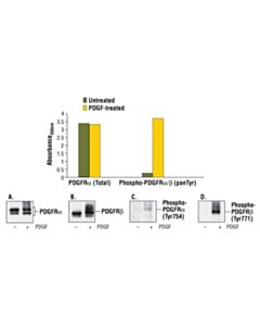 Cell Signaling Pathscan Phospho-Pdgf Receptor Alpha/Beta (Pantyr) Sandwich ELISA Kit