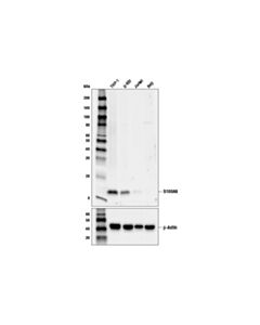 Cell Signaling S100a9 (D5o6o) Rabbit mAb