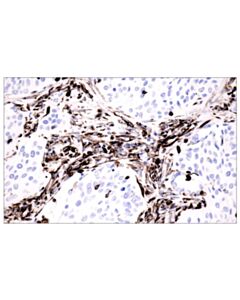 Cell Signaling Signalstain Deep Black Peroxidase Substrate Kit