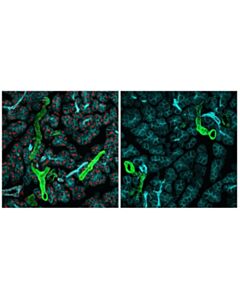 Cell Signaling Ctcf (D31h2) Xp ® Rabbit mAb (Alexa Fluor ® 555 Conjugate)