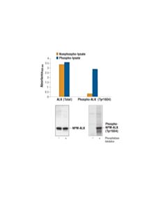 Cell Signaling Pathscan Phospho-Alk (Tyr1604) Sandwich ELISA Kit