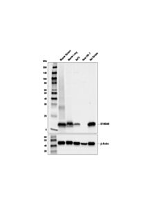 Cell Signaling S100A9 (D3U8M) Rabbit mAb 20 uL