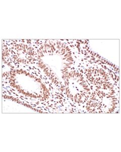 Cell Signaling CBP (D6C5) Rabbit Monoclonal Antibody