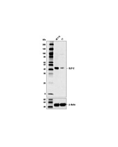 Cell Signaling SLP-2 (D5N4E) Rabbit mAb 20 uL
