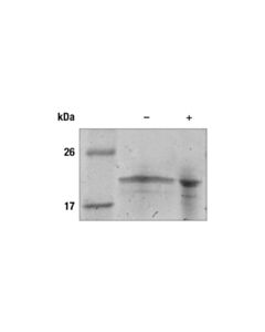 Cell Signaling Human RANKL Recombinant Protein