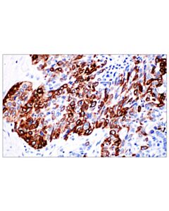Cell Signaling Keratin 14 (E7w6v) Rabbit mAb