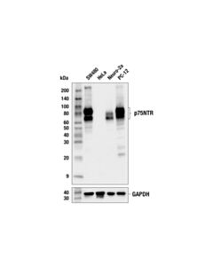 Cell Signaling p75NTR (E7U5R) Mouse mAb 20 uL