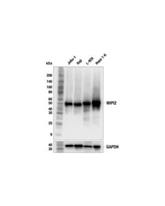 Cell Signaling WIPI2 (2A2) Mouse mAb