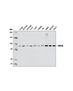 Cell Signaling Ube3a (D10d3) Rabbit mAb