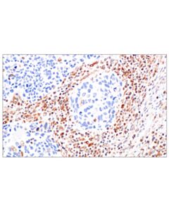 Cell Signaling TAP2 (E8G5I) Rabbit mAb (IHC Formulated)