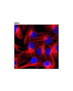 Cell Signaling Beta-Tubulin (9f3) Rabbit mAb (Alexa Fluor 594 Conjugate)