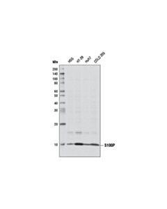 Cell Signaling S100p Antibody