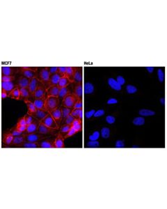 Cell Signaling E-Cadherin (24e10) Rabbit mAb (Alexa Fluor 594 Conjugate)