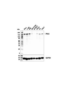 Cell Signaling Pfas (E4m7r) Rabbit mAb