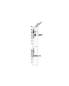 Cell Signaling Phospho-Tau (Ser214) (D1q2x) Rabbit mAb