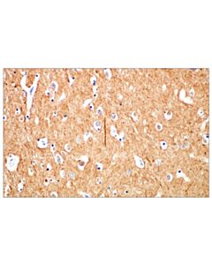 Cell Signaling Beta3-Tubulin (E9f3e) Mouse mAb (BSA And Azide Free)