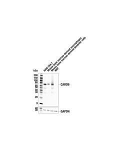 Cell Signaling Card9 (E4n1e) Rabbit mAb