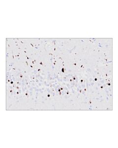 Cell Signaling Phospho-TDP43 (Ser409/Ser410) (F9S3F) Rabbit Monoclonal Antibody