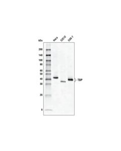 Cell Signaling Tbp (D5c9h) Xp® Rabbit mAb (Hrp Conjugate)