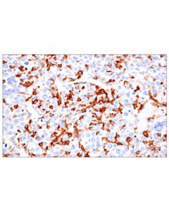 Cell Signaling CD162/PSGL-1 (F6N5G) Rabbit Monoclonal Antibody