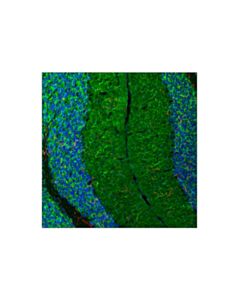 Cell Signaling MAP2 (F6R4S) Mouse mAb