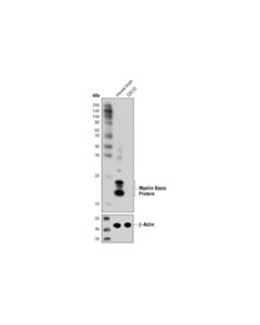 Cell Signaling Myelin Basic Protein (D8x4q) Xp Rabbit mAb