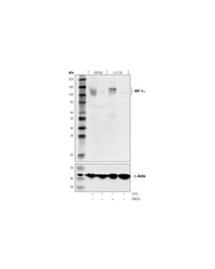 Cell Signaling Hif-1alpha (D5f3m) Mouse mAb