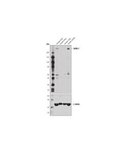 Cell Signaling Sorl1 (D8d4g) Rabbit mAb