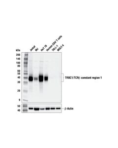 Cell Signaling Trbc1/Tcrbeta Constant Region 1 (E6z3s) Rabbit mAb