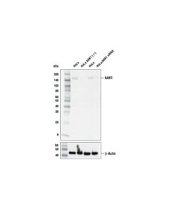Cell Signaling Aak1 Antibody