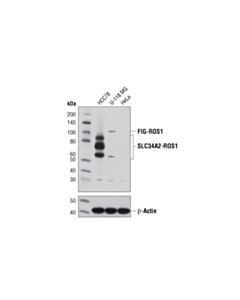 Cell Signaling Lung Cancer Rtk Antibody Sampler Kit