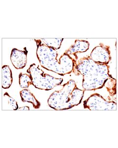 Cell Signaling Gdf15/Mic1 (E5q8q) Rabbit mAb