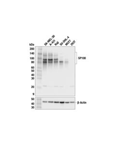 Cell Signaling SP100 (F1H6X) Rabbit mAb