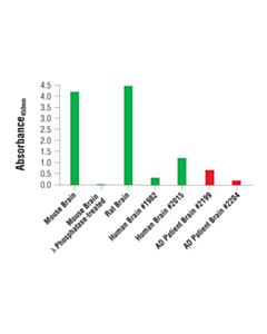 Cell Signaling Pathscan Phospho-Tau (Ser404) Sandwich ELISA Kit