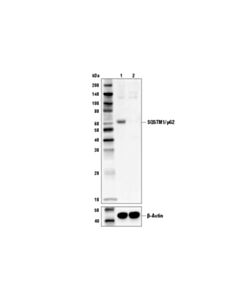 Cell Signaling Sqstm1/P62 (D5e2) Rabbit mAb