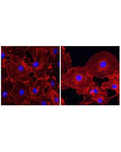 Cell Signaling Beta-Actin (13e5) Rabbit mAb (Alexa Fluor 555 Conjugate)