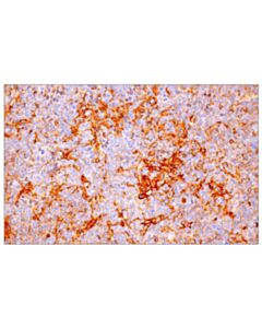 Cell Signaling PD-L1 (F3Z1T) Rabbit mAb (IHC Formulated)